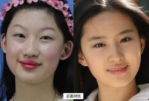 整容成明星脸,揭秘整容成明星脸的蜕变之路
